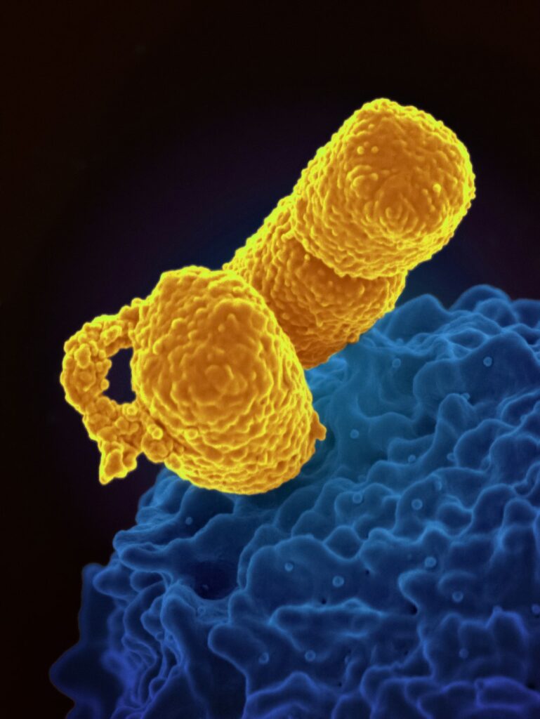 Klebsiella pneumoniae Bacteria A human neutrophil interacting with Klebsiella pneumoniae (yellow), a multidrug–resistant bacterium that causes severe hospital infections. Image captured at NIAIDs Rocky Mountain Laboratories (RML) in Hamilton, Montana. Credit: NIAID https://www.flickr.com/photos/niaid/53169319608/